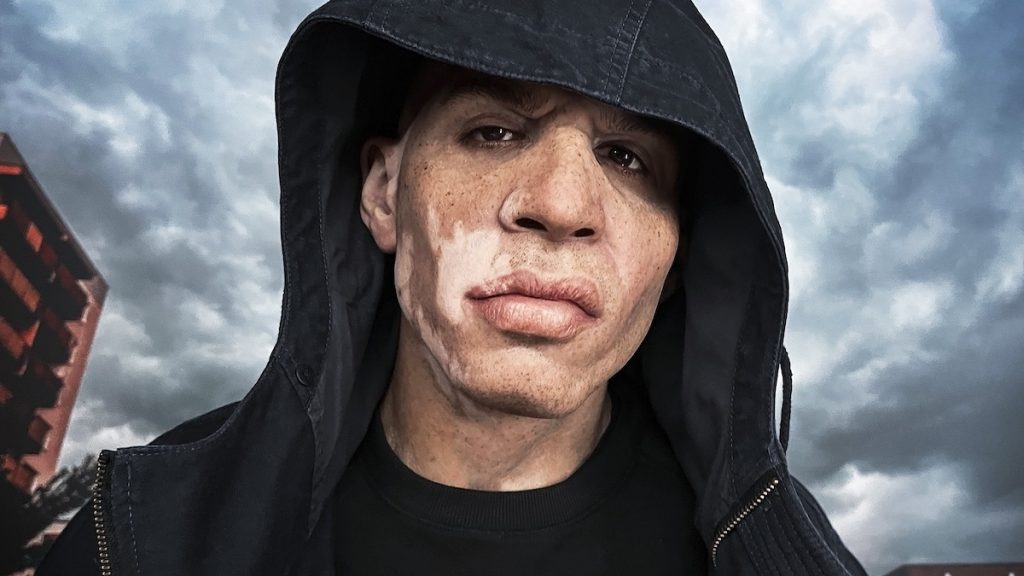 CASISDEAD Puts Fans Out Of Their Misery With Debut LP ‘Famous Last Words’
